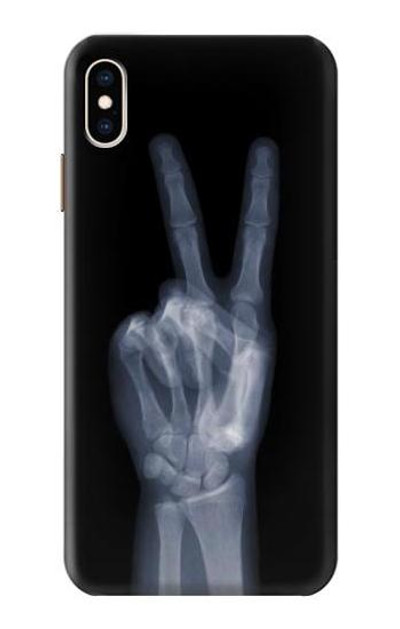 S3101 X-ray Peace Sign Fingers Case Cover Custodia per iPhone XS Max