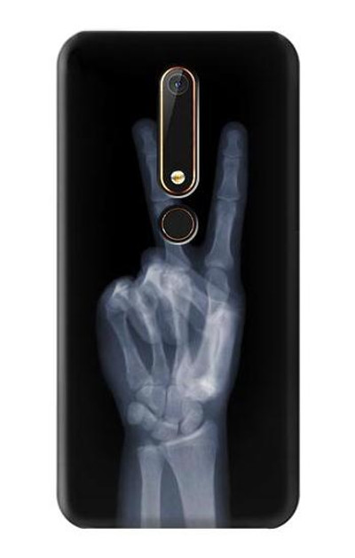 S3101 X-ray Peace Sign Fingers Case Cover Custodia per Nokia 6.1, Nokia 6 2018