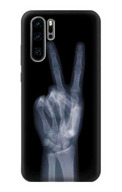 S3101 X-ray Peace Sign Fingers Case Cover Custodia per Huawei P30 Pro