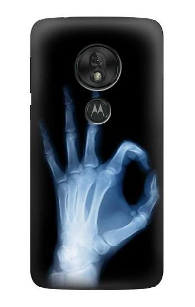 S3239 X-Ray Hand Sign OK Case Cover Custodia per Motorola Moto G7 Play