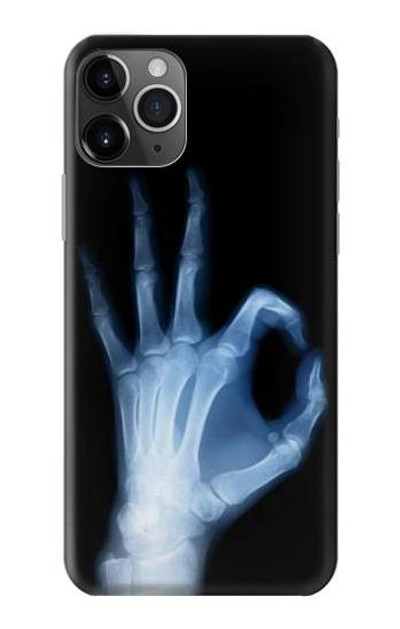 S3239 X-Ray Hand Sign OK Case Cover Custodia per iPhone 11 Pro