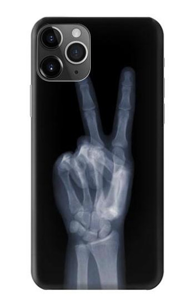 S3101 X-ray Peace Sign Fingers Case Cover Custodia per iPhone 11 Pro Max