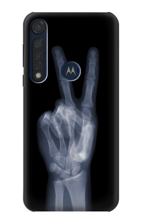 S3101 X-ray Peace Sign Fingers Case Cover Custodia per Motorola Moto G8 Plus