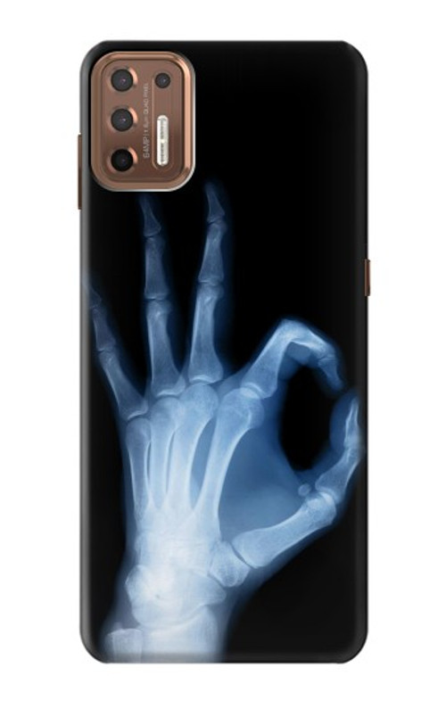 S3239 X-Ray Hand Sign OK Case Cover Custodia per Motorola Moto G9 Plus