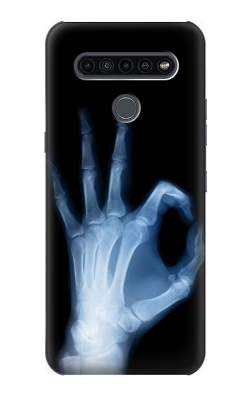 S3239 X-Ray Hand Sign OK Case Cover Custodia per LG K41S