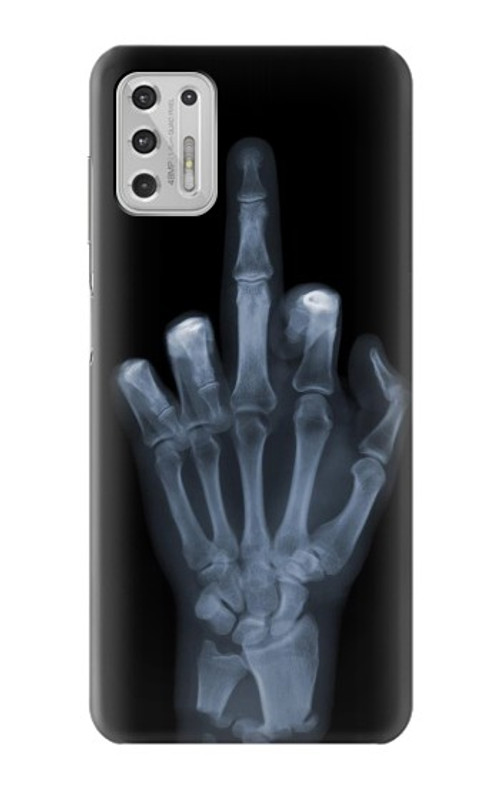 S1143 X-ray Hand Middle Finger Case Cover Custodia per Motorola Moto G Stylus (2021)
