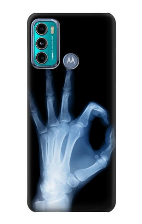 S3239 X-Ray Hand Sign OK Case Cover Custodia per Motorola Moto G60, G40 Fusion