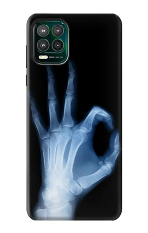 S3239 X-Ray Hand Sign OK Case Cover Custodia per Motorola Moto G Stylus 5G