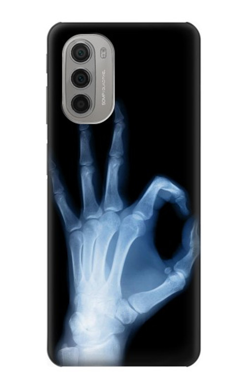 S3239 X-Ray Hand Sign OK Case Cover Custodia per Motorola Moto G51 5G S3239 X-Ray Hand Sign OK Case Cover Custodia per Motorola Moto G51 5G