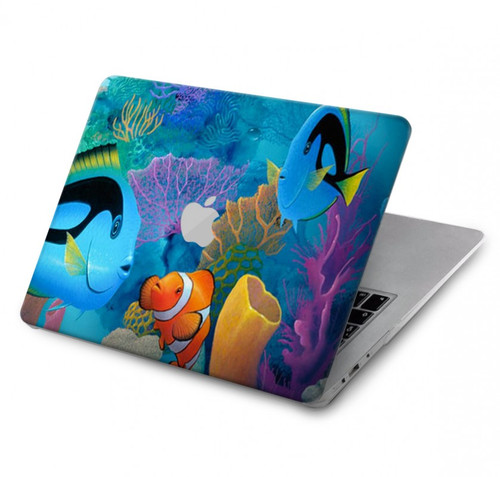 S3227 Underwater World Cartoon Case Cover Custodia per MacBook Pro 16 M1,M2 (2021,2023) - A2485, A2780