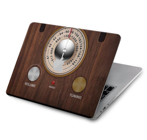 S3935 FM AM Radio Tuner Graphic Case Cover Custodia per MacBook Air 13″ (2022,2025) - A2681, A3113, A3240