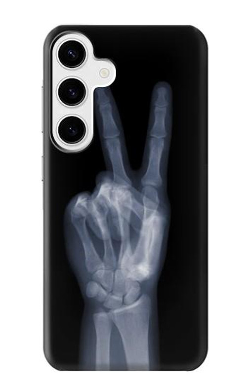 S3101 X-ray Peace Sign Fingers Case Cover Custodia per Samsung Galaxy S24 Plus