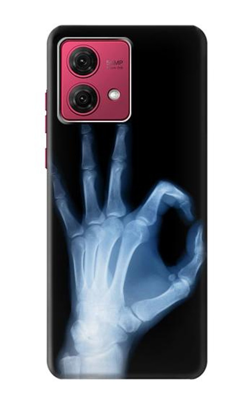 S3239 X-Ray Hand Sign OK Case Cover Custodia per Motorola Moto G84 S3239 X-Ray Hand Sign OK Case Cover Custodia per Motorola Moto G84