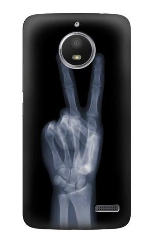 S3101 X-ray Peace Sign Fingers Case Cover Custodia per Motorola Moto E4