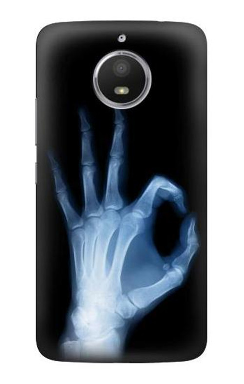 S3239 X-Ray Hand Sign OK Case Cover Custodia per Motorola Moto E4 Plus