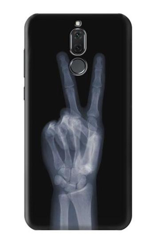 S3101 X-ray Peace Sign Fingers Case Cover Custodia per Huawei Mate 10 Lite