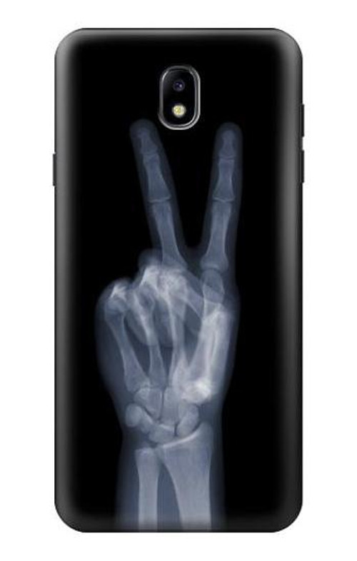 S3101 X-ray Peace Sign Fingers Case Cover Custodia per Samsung Galaxy J7 (2018), J7 Aero, J7 Top, J7 Aura, J7 Crown, J7 Refine, J7 Eon, J7 V 2nd Gen, J7 Star