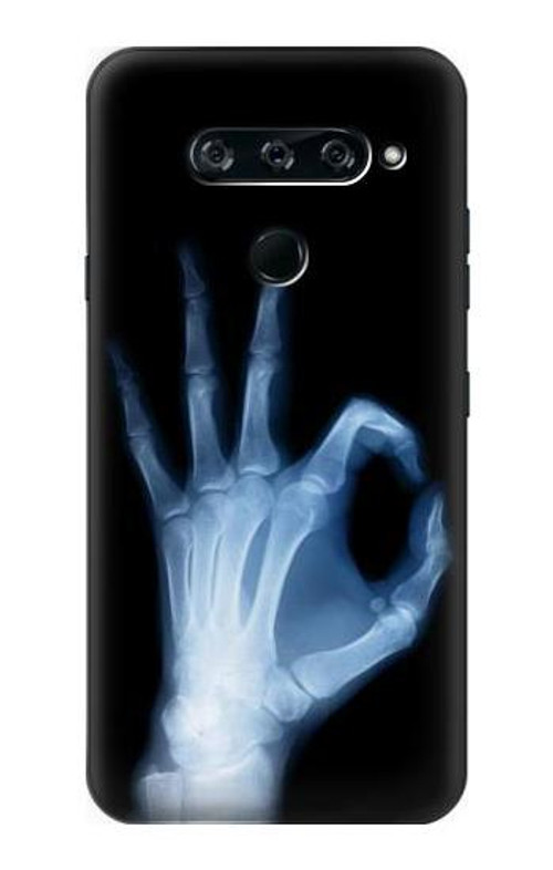 S3239 X-Ray Hand Sign OK Case Cover Custodia per LG V40, LG V40 ThinQ