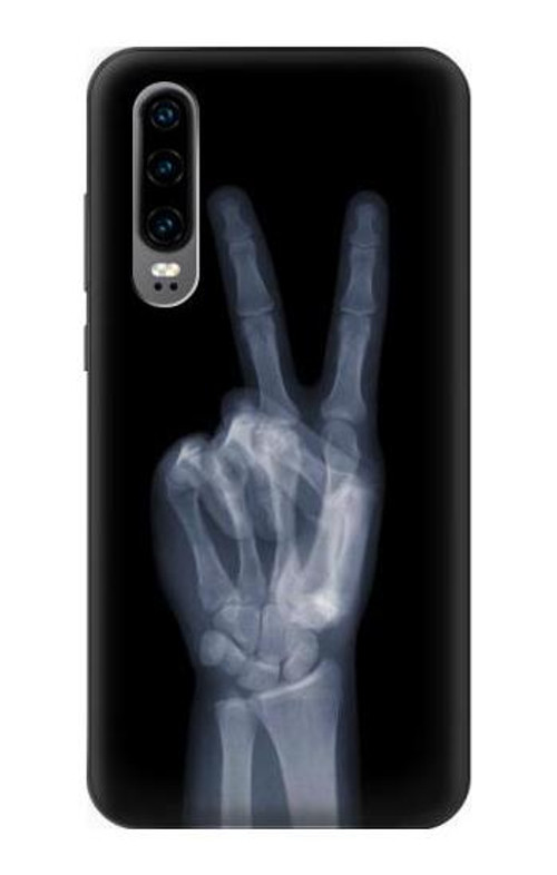 S3101 X-ray Peace Sign Fingers Case Cover Custodia per Huawei P30