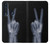 S3101 X-ray Peace Sign Fingers Case Cover Custodia per Motorola Moto G8 Plus