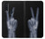 S3101 X-ray Peace Sign Fingers Case Cover Custodia per Motorola One Action (Moto P40 Power)