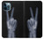 S3101 X-ray Peace Sign Fingers Case Cover Custodia per iPhone 12 Pro Max