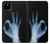 S3239 X-Ray Hand Sign OK Case Cover Custodia per Google Pixel 4a 5G