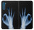 S3239 X-Ray Hand Sign OK Case Cover Custodia per Motorola One Fusion+