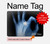 S3239 X-Ray Hand Sign OK Case Cover Custodia per MacBook Pro Retina 13″ - A1425, A1502