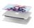 S3711 Pink Pineapple Case Cover Custodia per MacBook Pro 15″ - A1707, A1990