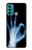 S3239 X-Ray Hand Sign OK Case Cover Custodia per Motorola Moto G60, G40 Fusion