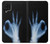 S3239 X-Ray Hand Sign OK Case Cover Custodia per Samsung Galaxy M22