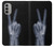 S3101 X-ray Peace Sign Fingers Case Cover Custodia per Motorola Moto G51 5G S3101 X-ray Peace Sign Fingers Case Cover Custodia per Motorola Moto G51 5G