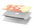 S0815 Pregnant Art Case Cover Custodia per MacBook Pro 14 M1,M2,M3 (2021,2023) - A2442, A2779, A2992, A2918