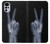 S3101 X-ray Peace Sign Fingers Case Cover Custodia per Motorola Moto G22