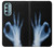 S3239 X-Ray Hand Sign OK Case Cover Custodia per Motorola Moto G Stylus 5G (2022)