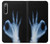 S3239 X-Ray Hand Sign OK Case Cover Custodia per Sony Xperia 10 IV