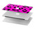S1850 Pink Leopard Pattern Case Cover Custodia per MacBook Air 13″ (2022,2024) - A2681, A3113