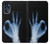 S3239 X-Ray Hand Sign OK Case Cover Custodia per Motorola Moto G (2022)