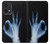 S3239 X-Ray Hand Sign OK Case Cover Custodia per OnePlus Nord CE 2 Lite 5G