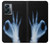 S3239 X-Ray Hand Sign OK Case Cover Custodia per OnePlus Nord N300