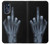 S1143 X-ray Hand Middle Finger Case Cover Custodia per Motorola Moto G 5G (2023)