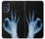 S3239 X-Ray Hand Sign OK Case Cover Custodia per Motorola Moto G 5G (2023)