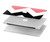 S1849 Pink Black Chevron Zigzag Case Cover Custodia per MacBook Air 15″ (2023,2024) - A2941, A3114