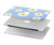 S3681 Daisy Flowers Pattern Case Cover Custodia per MacBook Air 15″ (2023,2024,2025) - A2941, A3114, A3241