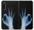 S3239 X-Ray Hand Sign OK Case Cover Custodia per Sony Xperia 10 V