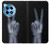 S3101 X-ray Peace Sign Fingers Case Cover Custodia per OnePlus 12R