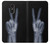 S3101 X-ray Peace Sign Fingers Case Cover Custodia per LG K10 (2018), LG K30