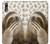 S3559 Sloth Pattern Case Cover Custodia per Huawei P20