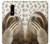 S3559 Sloth Pattern Case Cover Custodia per OnePlus 6